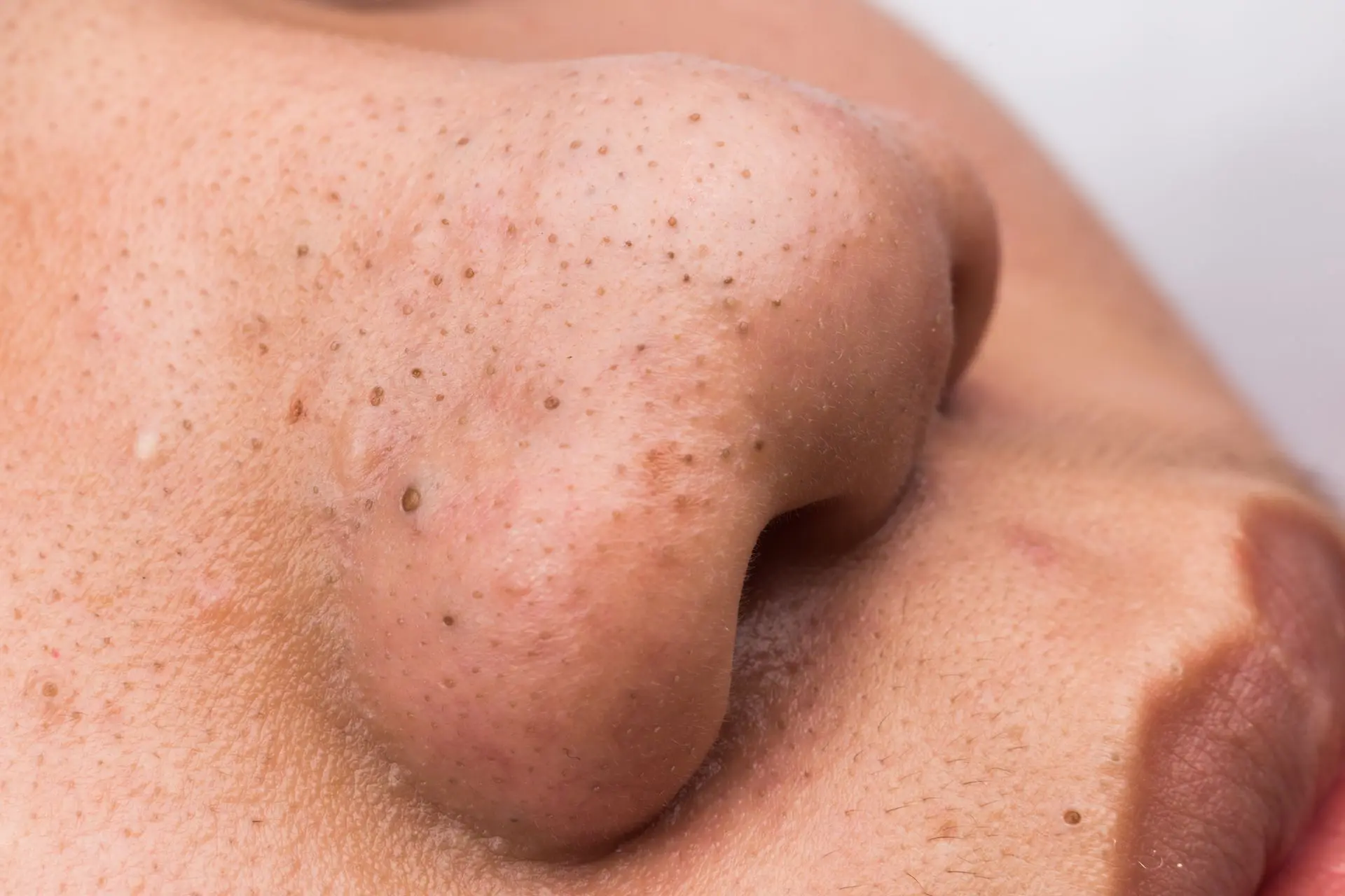 Body and enhancement treatments at Eclipse Spa